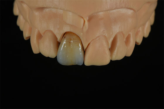 kwaliteit  Affordable Zirconia Crowns with Custom Color Staining - China Dental Lab fabriek
